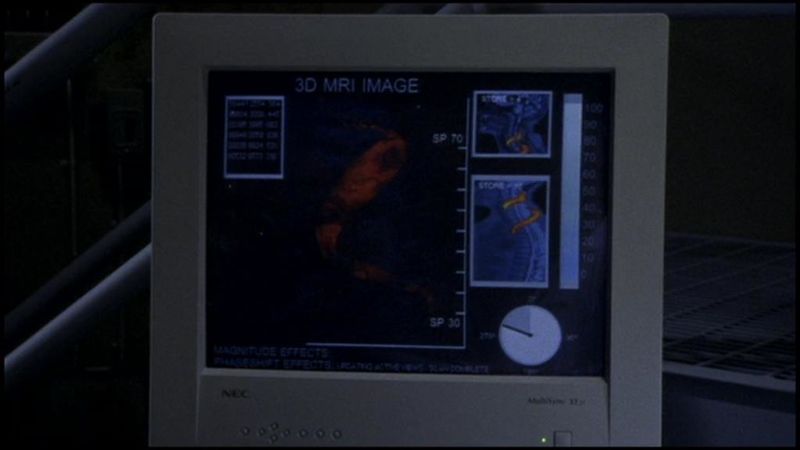 File:Charles Kawalsky's MRI.jpg