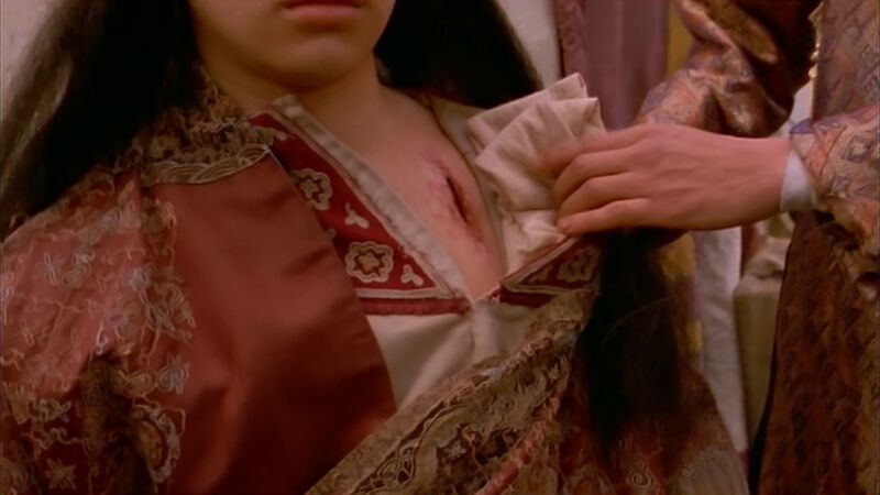 File:Shavadai anesthetic in Emancipation.jpg